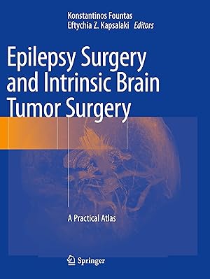 Seller image for Epilepsy Surgery and Intrinsic Brain Tumor Surgery for sale by moluna