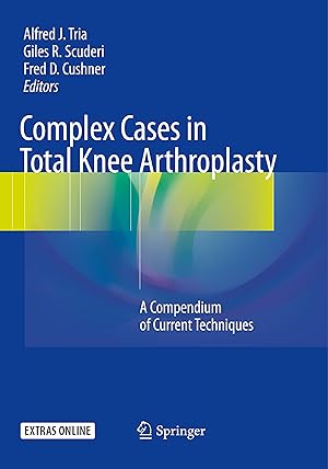 Seller image for Complex Cases in Total Knee Arthroplasty for sale by moluna