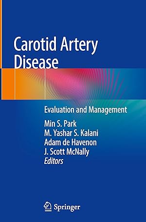 Seller image for Carotid Artery Disease for sale by moluna