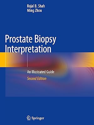 Seller image for Prostate Biopsy Interpretation for sale by moluna