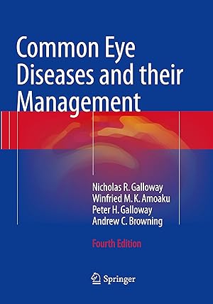 Seller image for Common Eye Diseases and their Management for sale by moluna