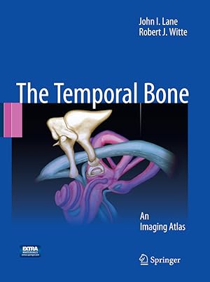 Seller image for Temporal Bone for sale by moluna