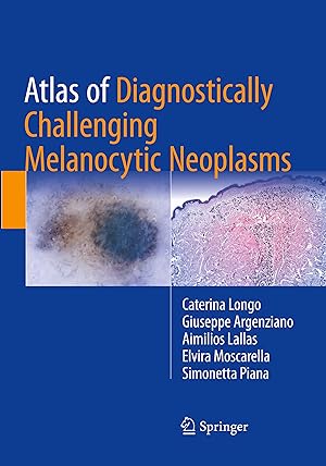Immagine del venditore per Atlas of Diagnostically Challenging Melanocytic Neoplasms venduto da moluna