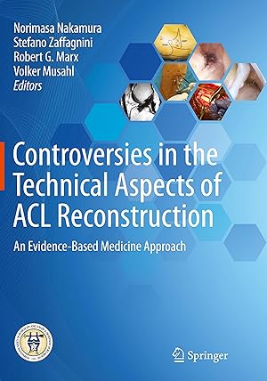 Seller image for Controversies in the Technical Aspects of ACL Reconstruction for sale by moluna