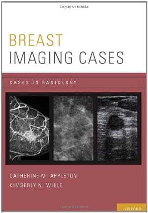 Bild des Verkufers fr Breast Imaging Cases (Cases in Radiology) by Appleton, Catherine M., Wiele, Kimberly N. [Paperback ] zum Verkauf von booksXpress
