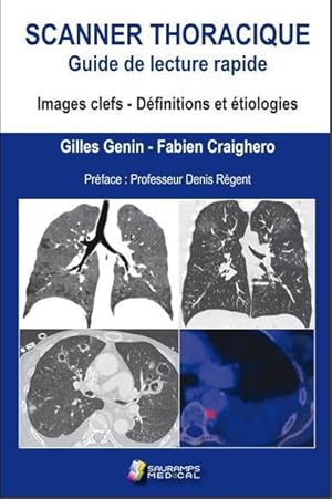 scanner thoracique, guide de lecture rapide - images clefs, définitions et étiologies