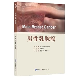 Bild des Verkufers fr Male Breast Cancer(Chinese Edition) zum Verkauf von liu xing