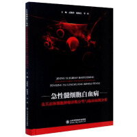 Immagine del venditore per Diagnosis and clinical case analysis of acute myeloid leukemia and its precursor cell tumors(Chinese Edition) venduto da liu xing