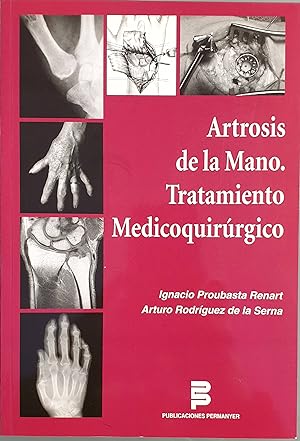 Bild des Verkufers fr Artrosis de la mano. Tratamiento medicoquirrgico zum Verkauf von Los libros del Abuelo