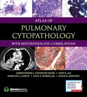 Seller image for Atlas of Pulmonary Cytopathology : With Histopathologic Correlations for sale by GreatBookPrices