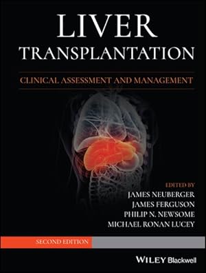 Seller image for Liver Transplantation : Clinical Assessment and Management for sale by GreatBookPrices