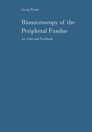 Seller image for Biomicroscopy of the Peripheral Fundus An Atlas and Textbook for sale by NEPO UG