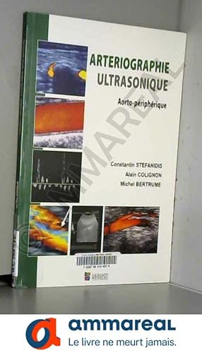 Bild des Verkufers fr Arteriographie ultrasonique : Aorto-priphrique zum Verkauf von Ammareal
