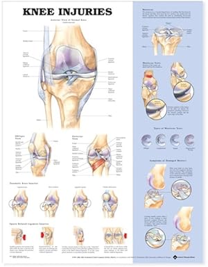 Imagen del vendedor de Knee Injuries Anatomical Chart a la venta por GreatBookPrices