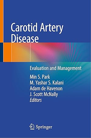 Seller image for Carotid Artery Disease for sale by moluna