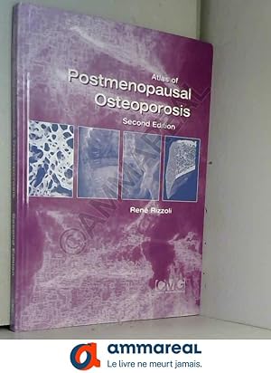 Bild des Verkufers fr Atlas of postmenopausal osteoporosis zum Verkauf von Ammareal