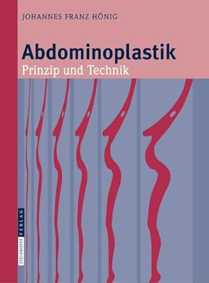 Immagine del venditore per Abdominoplastik : Prinzip und Technik venduto da AHA-BUCH GmbH