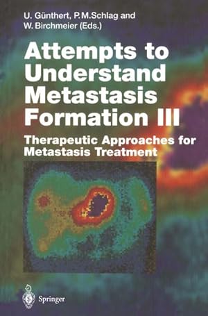 Seller image for Attempts to Understand Metastasis Formation III : Therapeutic Approaches for Metastasis Treatment for sale by AHA-BUCH GmbH