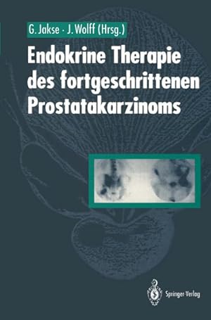 Bild des Verkufers fr Endokrine Therapie des fortgeschrittenen Prostatakarzinoms zum Verkauf von AHA-BUCH GmbH