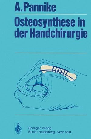 Bild des Verkufers fr Osteosynthese in der Handchirurgie zum Verkauf von AHA-BUCH GmbH