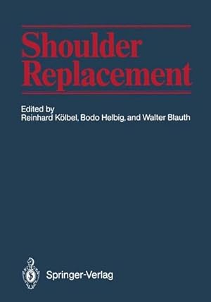 Immagine del venditore per Shoulder Replacement venduto da AHA-BUCH GmbH