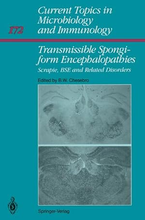 Seller image for Transmissible Spongiform Encephalopathies: : Scrapie, BSE and Related Human Disorders for sale by AHA-BUCH GmbH