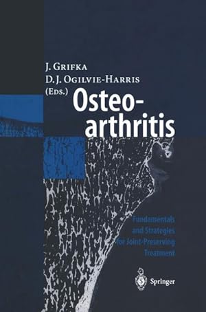 Bild des Verkufers fr Osteoarthritis : Fundamentals and Strategies for Joint-Preserving Treatment zum Verkauf von AHA-BUCH GmbH
