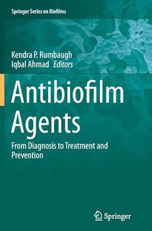 Bild des Verkufers fr Antibiofilm Agents : From Diagnosis to Treatment and Prevention zum Verkauf von AHA-BUCH GmbH