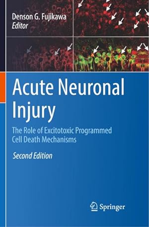 Immagine del venditore per Acute Neuronal Injury : The Role of Excitotoxic Programmed Cell Death Mechanisms venduto da AHA-BUCH GmbH