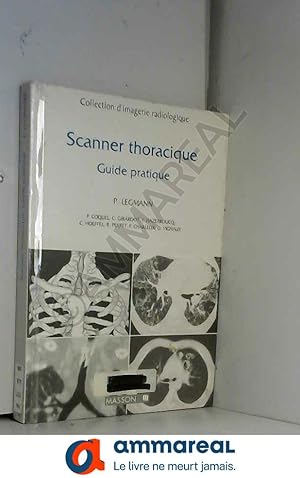 Image du vendeur pour Scanner thoracique: Guide pratique mis en vente par Ammareal