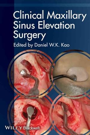 Immagine del venditore per Clinical Maxillary Sinus Elevation Surgery venduto da GreatBookPricesUK
