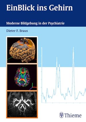 Bild des Verkufers fr EinBlick ins Gehirn: Moderne Bildgebung in der Psychiatrie zum Verkauf von Antiquariat Armebooks