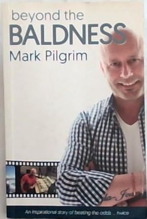 Seller image for Beyond the Baldness: An inspirational story of beating the odds . twice for sale by Chapter 1