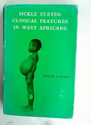 Sickle States: Clinical Features in West Africans.