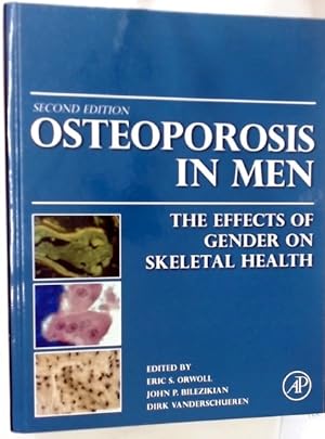 Seller image for Osteoporosis in Men: The Effects of Gender on Skeletal Health. for sale by Plurabelle Books Ltd