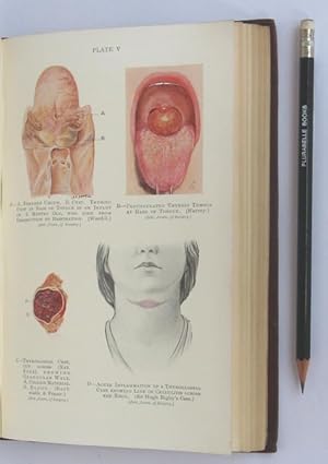 Bild des Verkufers fr The Tongue and Its Diseases. zum Verkauf von Plurabelle Books Ltd