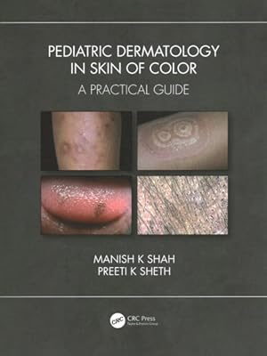 Imagen del vendedor de Pediatric Dermatology in Skin of Color : A Practical Guide a la venta por GreatBookPricesUK