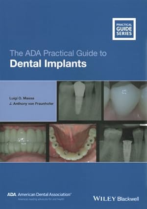 Image du vendeur pour ADA Practical Guide to Dental Implants mis en vente par GreatBookPrices