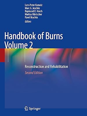 Image du vendeur pour Handbook of Burns Volume 2 mis en vente par moluna