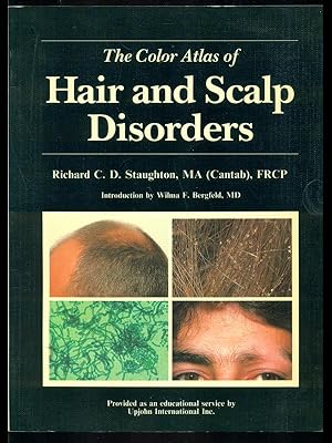 Hair and scalp disorders
