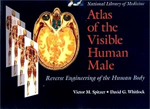 Bild des Verkufers fr Atlas of the Visible Human Male: Reverse Engineering of the Human Body zum Verkauf von LEFT COAST BOOKS