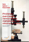 Prótesis parciales removibles metálicas, de resina y mixta