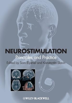 Immagine del venditore per Neurostimulation: Principles and Practice [Hardcover ] venduto da booksXpress