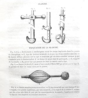 Des corps étrangers de l'oesophage, considérés principalement au point de vue de leur traitement....