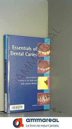 Imagen del vendedor de Essentials of Dental Caries: The Disease and Its Management a la venta por Ammareal