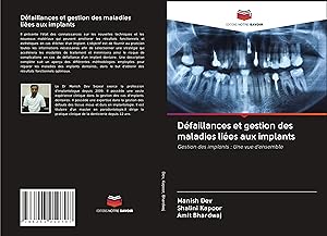 Bild des Verkufers fr Dfaillances et gestion des maladies lies aux implants zum Verkauf von moluna