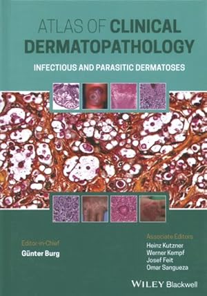 Bild des Verkufers fr Atlas of Clinical Dermatopathology : Infectious and Parasitic Dermatoses zum Verkauf von GreatBookPrices