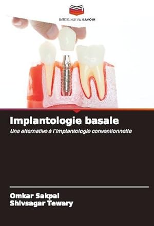 Seller image for Implantologie basale : Une alternative  l'implantologie conventionnelle for sale by AHA-BUCH GmbH