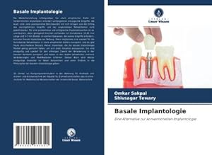 Seller image for Basale Implantologie : Eine Alternative zur konventionellen Implantologie for sale by AHA-BUCH GmbH
