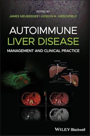 Bild des Verkufers fr Autoimmune Liver Disease : Management and Clinical Practice zum Verkauf von GreatBookPrices